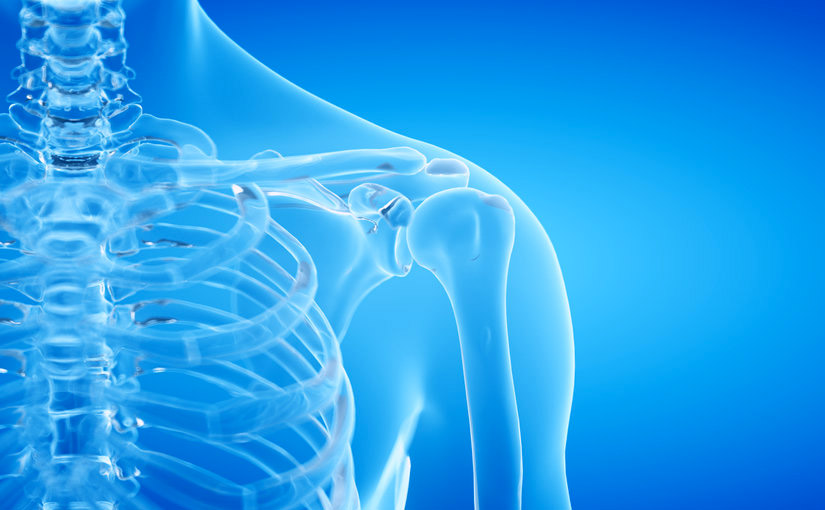 Albers Schonberg Hastalığı